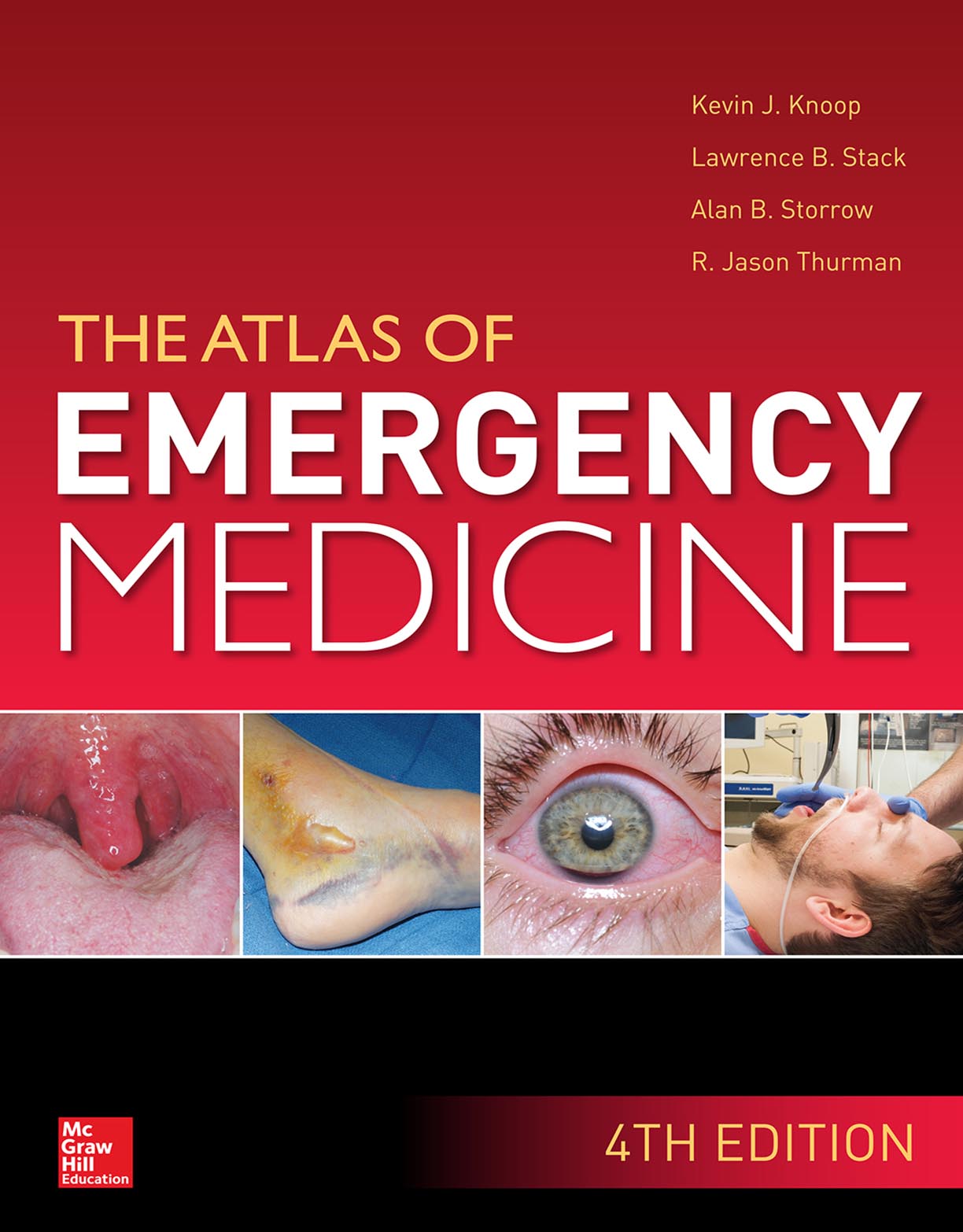 Atlas of Emergency Medicine 4e 2016 - Kevin J. Knoop